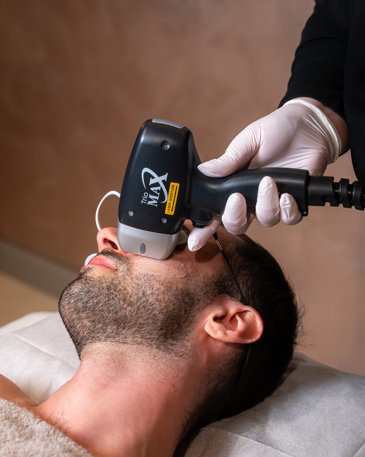 Carbon Laser-Peeling in Wien – Forever Hairless