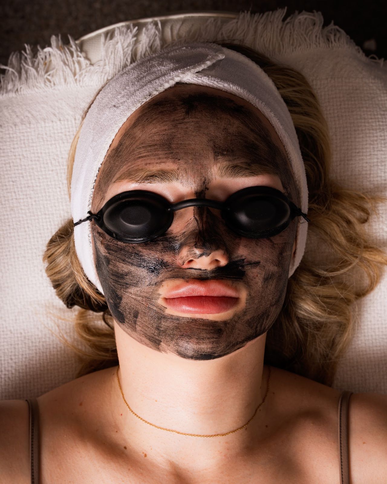 Carbon Laser-Peeling in Wien – Eindruck 2