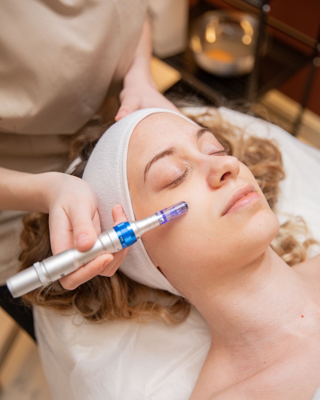 Microneedling in Wien